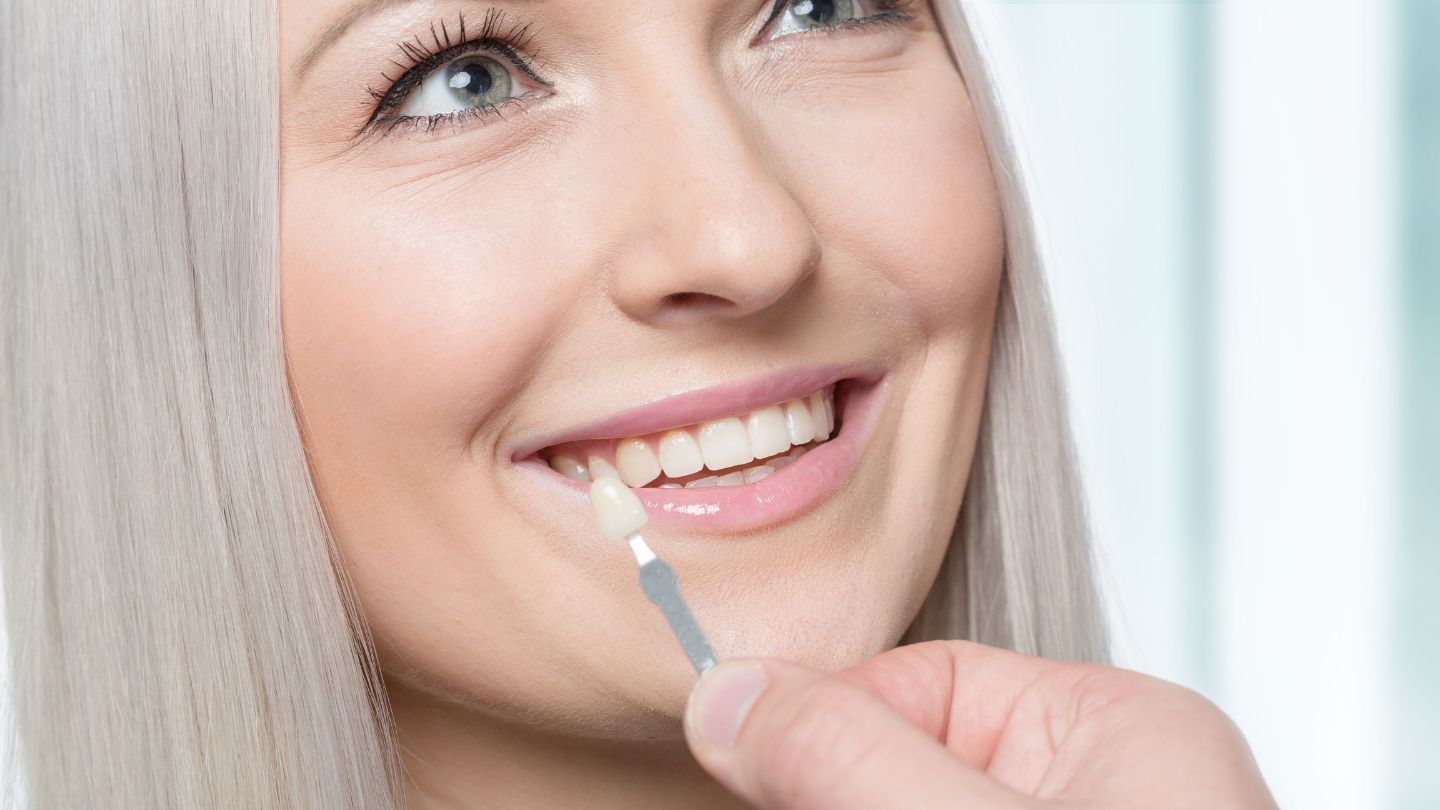 Tips for Choosing The Perfect Veneers for Your Smile